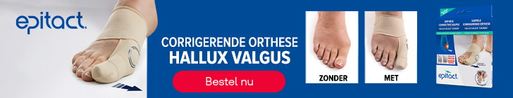 Banner voor de corrigerende Hallux Valgus-orthese van Epitact. Een persoon draagt een beige orthese rond de voet. Rechts tonen twee beelden een vergelijking van een voet &ldquo;zonder&rdquo; en &ldquo;met&rdquo; orthese om de correctie van de grote teen te illustreren. Rode knop &ldquo;Bestel nu&rdquo; op blauwe achtergrond.